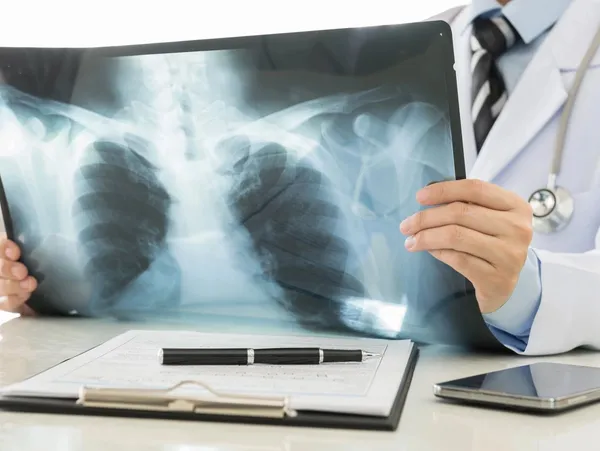 Doctor reviewing chest X-ray film